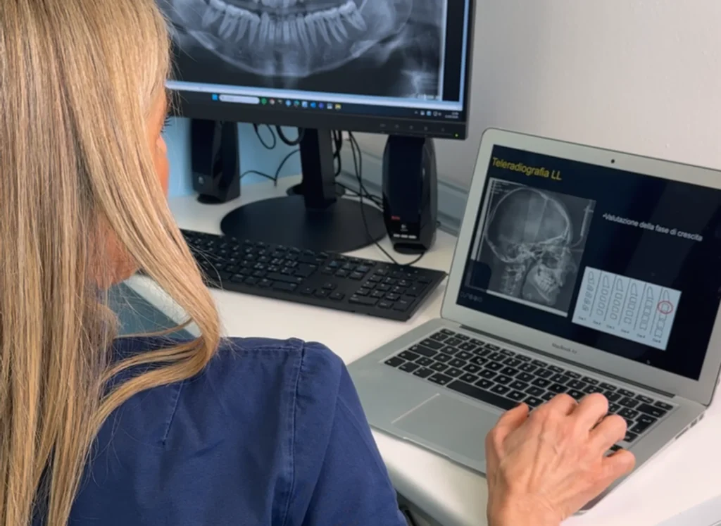 Quali sono le fasi principali di un intervento implantare 1 Quali sono le fasi principali di un intervento implantare
