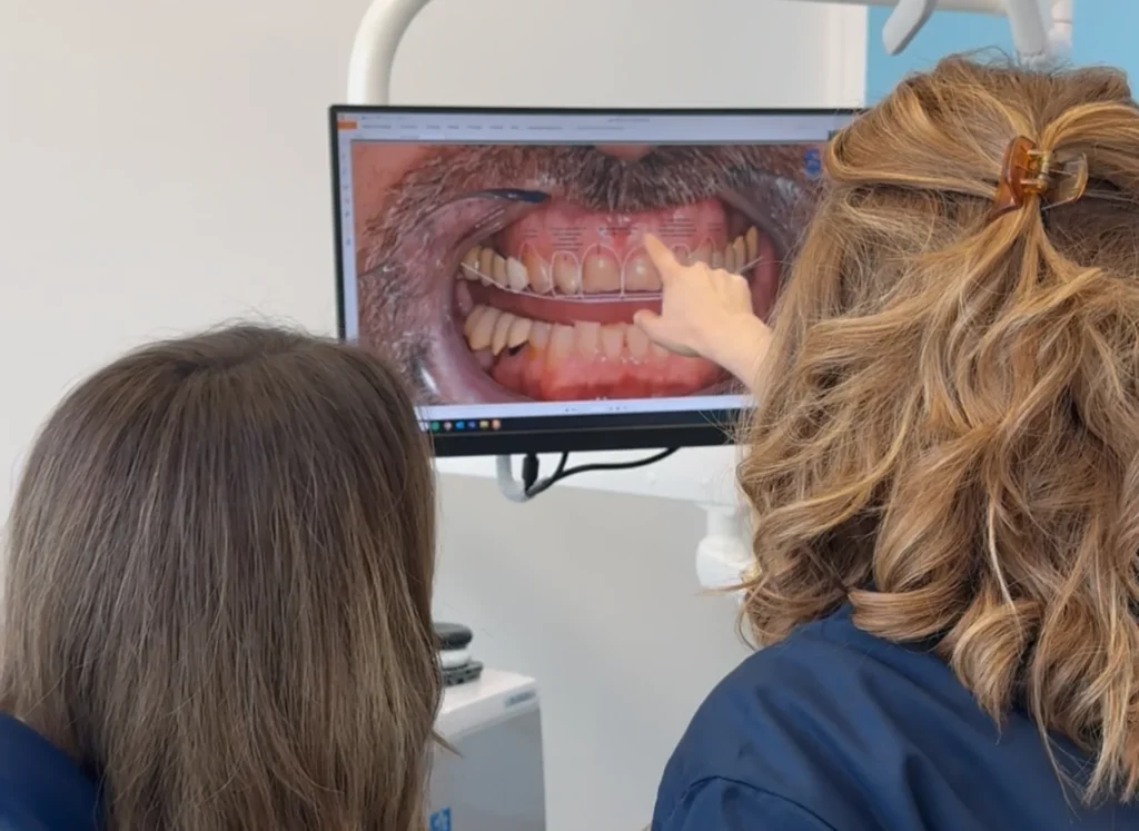 Faccette dentali e forma dei denti: cosa si può modificare 1 Faccette dentali e forma dei denti
