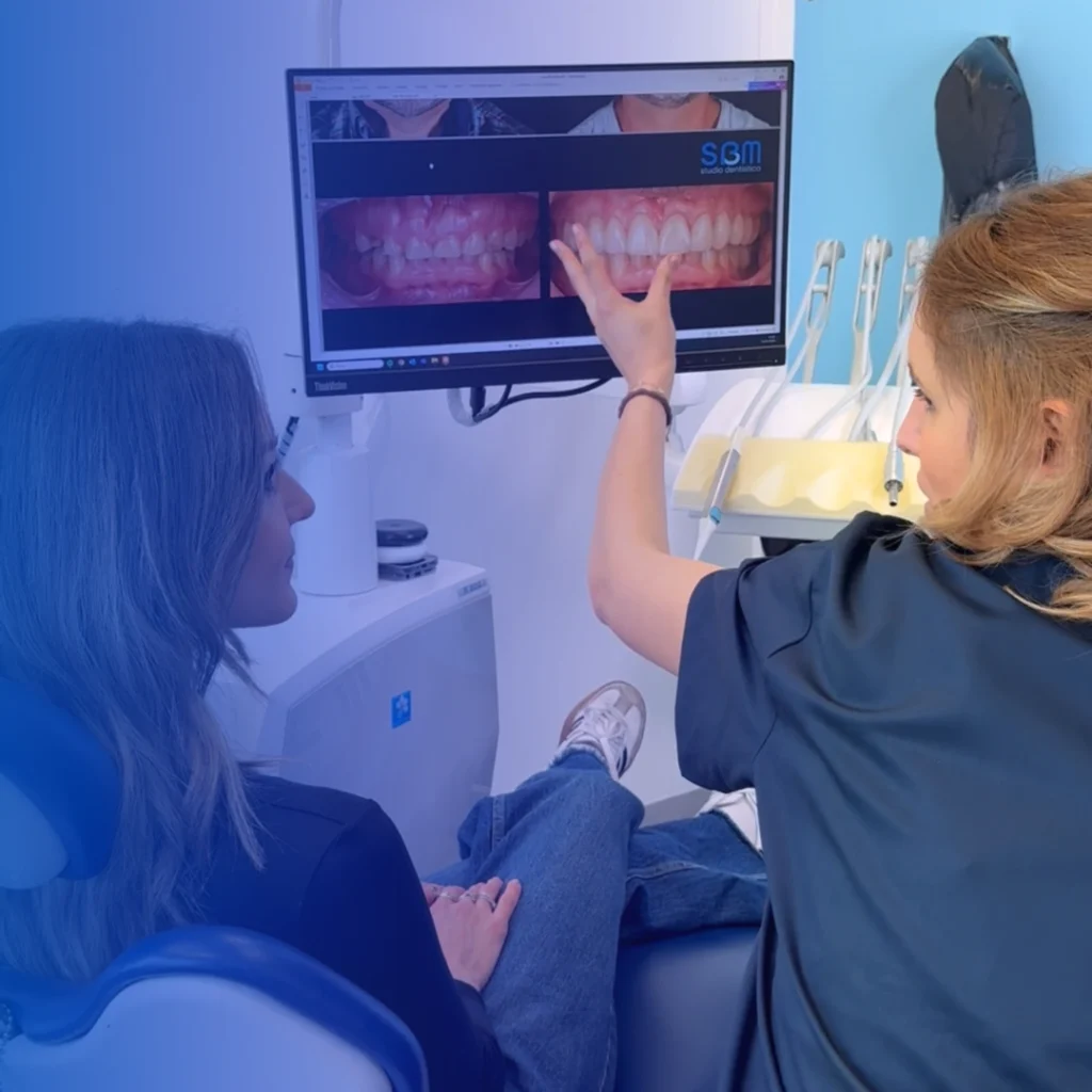 Home 16 Faccette dentali a Vicenza