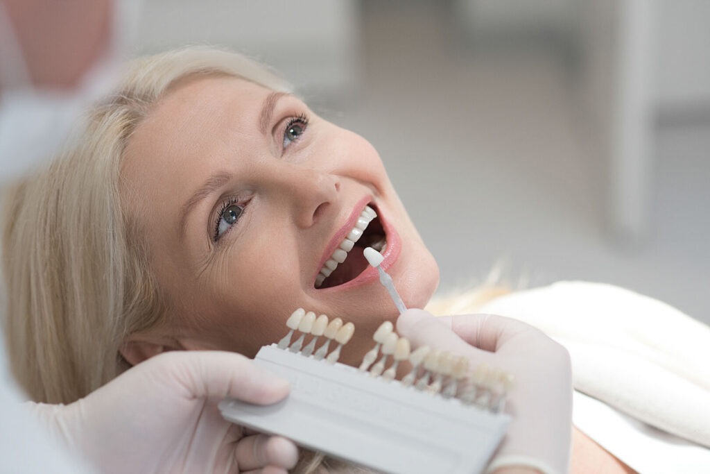 Le faccette dentali possono correggere i denti storti?
