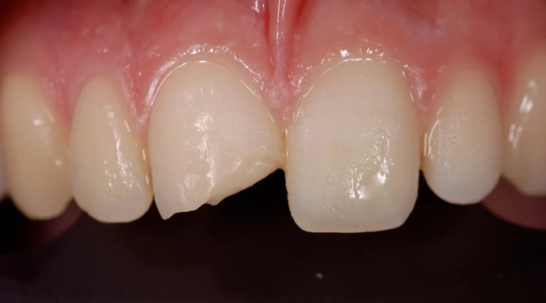 ricostruzioni estetiche