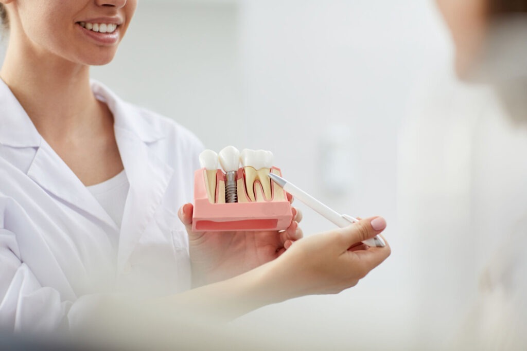Come riconoscere i sintomi di perimplantite e proteggere la salute degli impianti 1 come riconoscere i sintomi di perimplantite